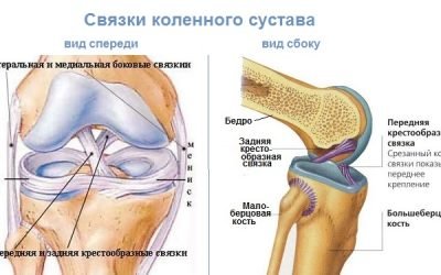 Розрив хрестоподібних зв’язок коліна — часткове і субтотальне (неповне) пошкодження хрестів колінного суглоба