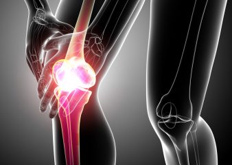 Пошкодження звязок колінного суглоба — симптоми і лікування в домашніх умовах, як довго заживає травма коліна і мазь для звязок