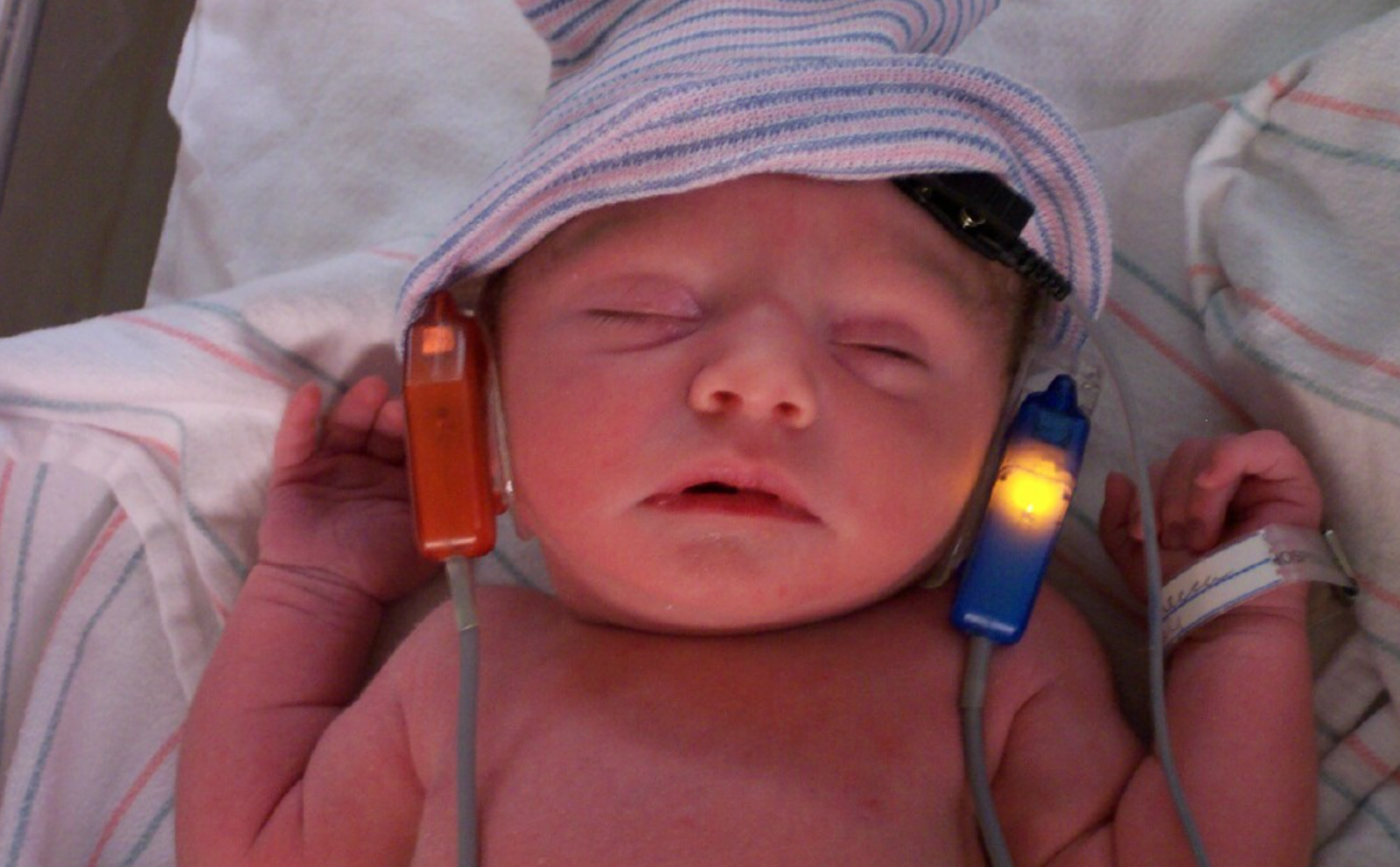 Глухота аномалия. Дети с нарушением слуха.. Врожденные нарушения слуха. Патологии слуха у детей. Аудиологический скрининг новорожденных.