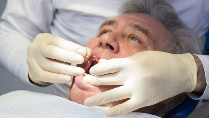 Кістогранульома зуба: причини, симптоми, методи лікування та профілактики