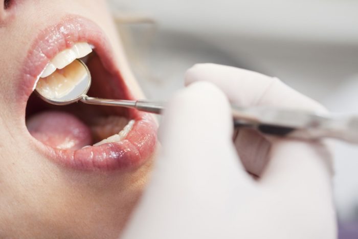 При жуванні болить запломбований зуб: причини і методи лікування