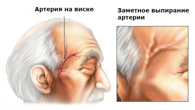 Причини болю у верхній щелепі ліворуч і праворуч
