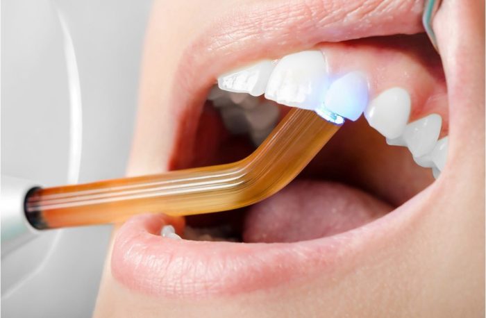 Зуб реагує на холодне після пломбування: причини і лікування