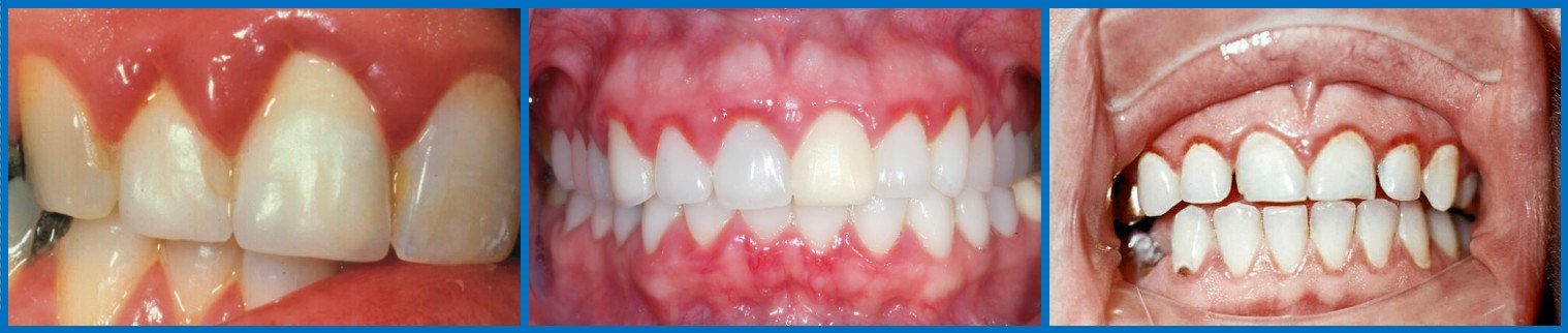 Зубні краплі: склад, принцип дії, інструкція по застосуванню